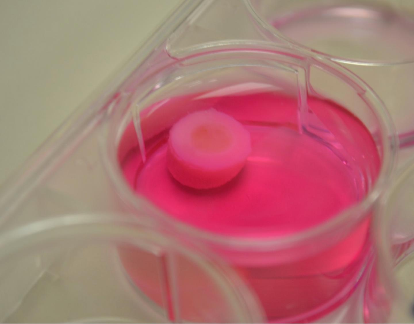 3D printed bio cartilage