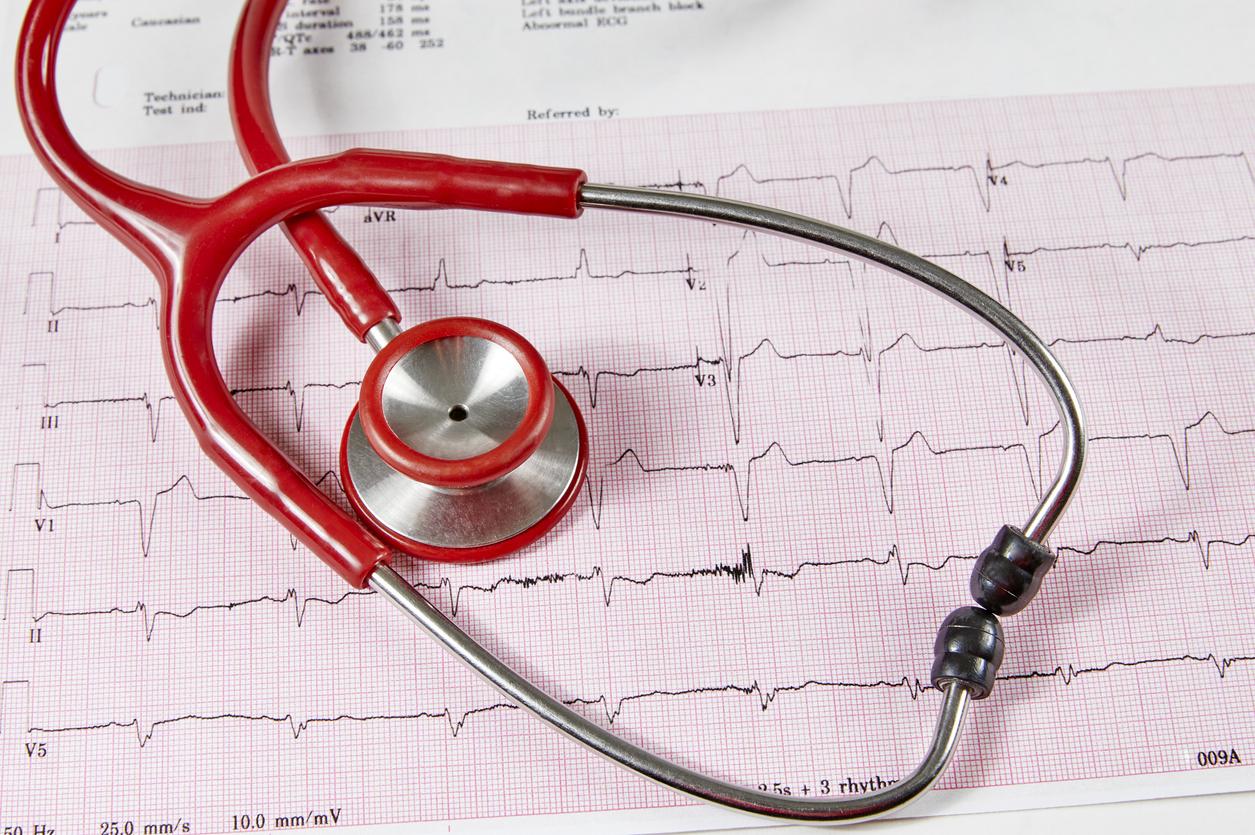 Fibrillation atriale : un nouveau traitement qui change la donne