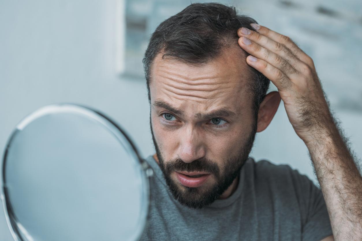 Calvitie : une découverte pour éviter la chute des cheveux ? 