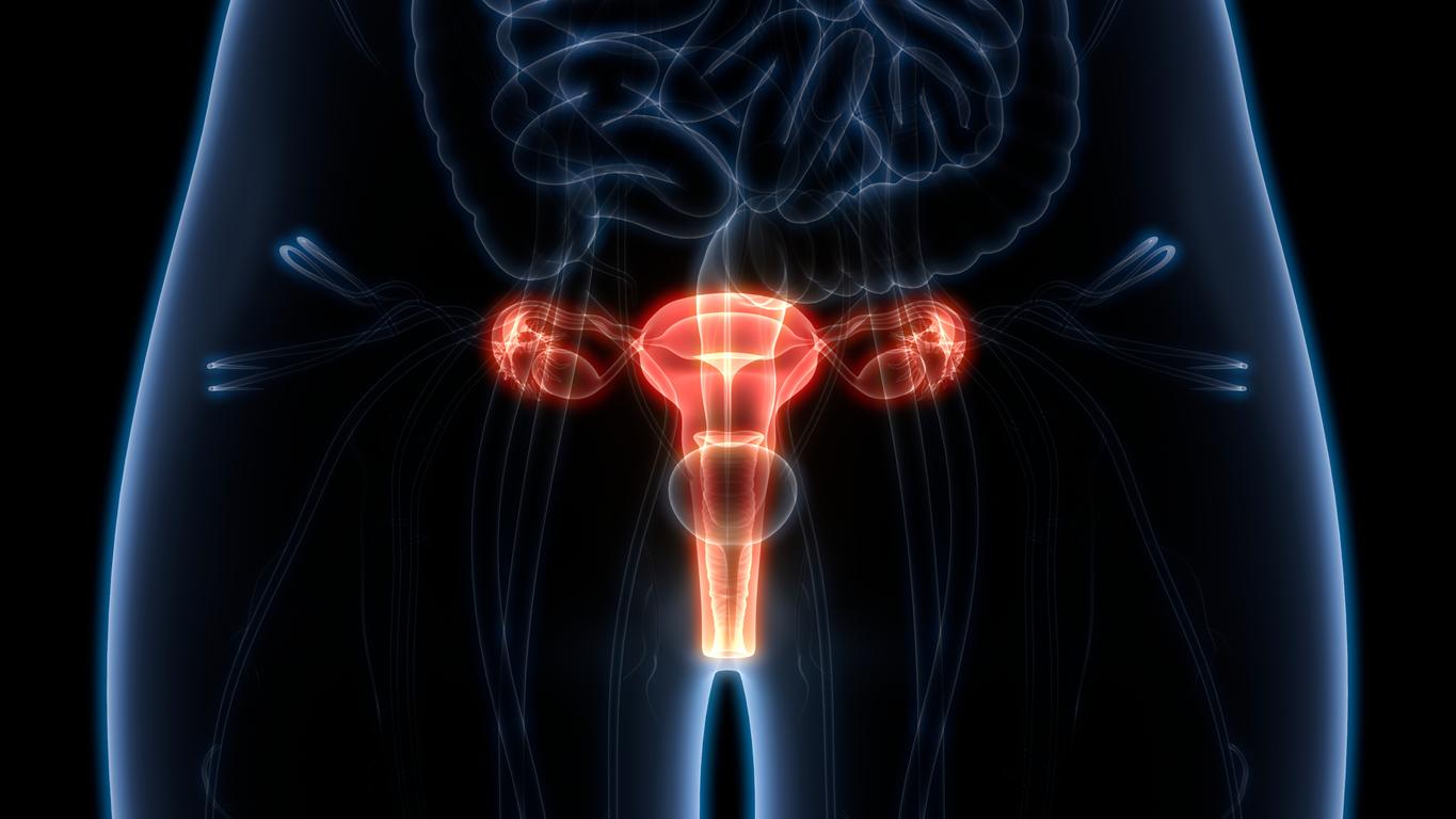 Ovarian Cancer Treatment: What are the 3 Main Drivers of Progress?