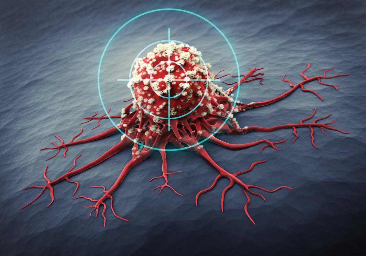 Cancer: How does it affect blood sugar?