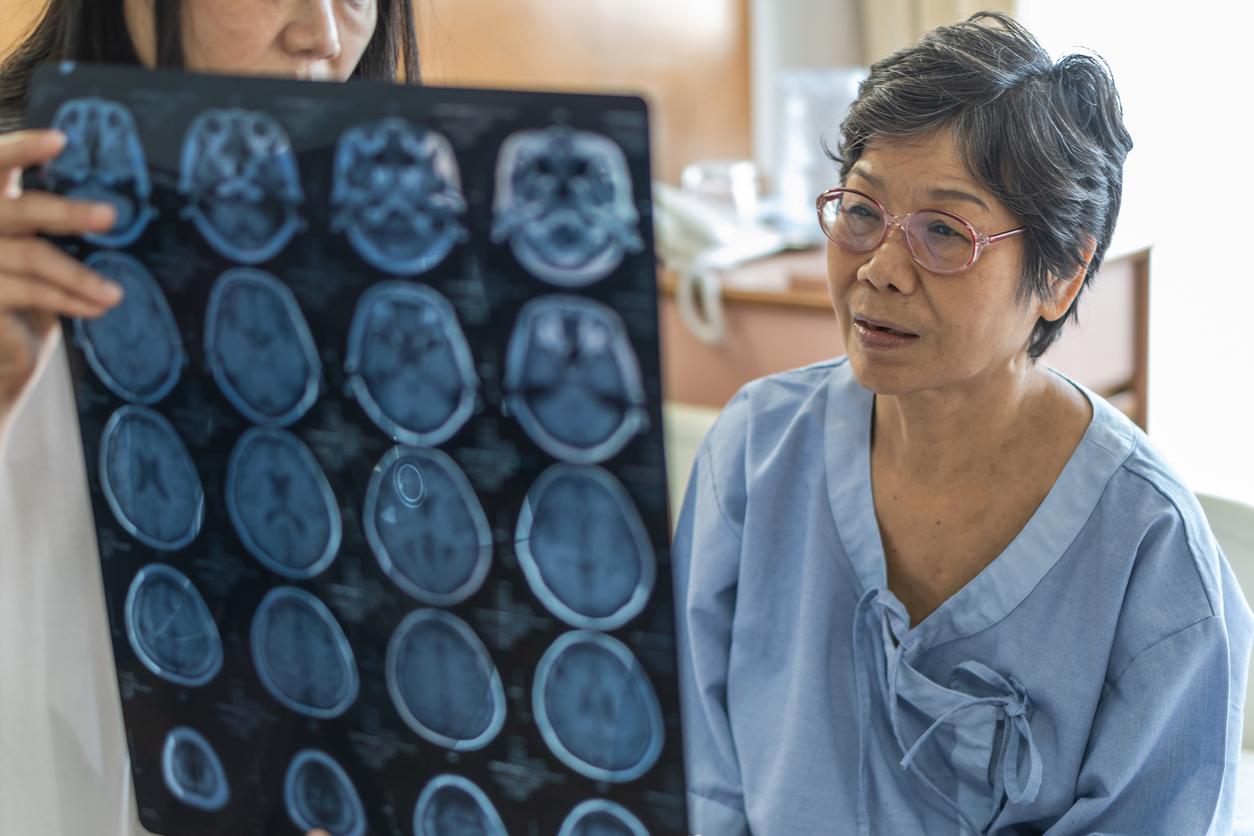 New AI accurately detects Alzheimer's disease