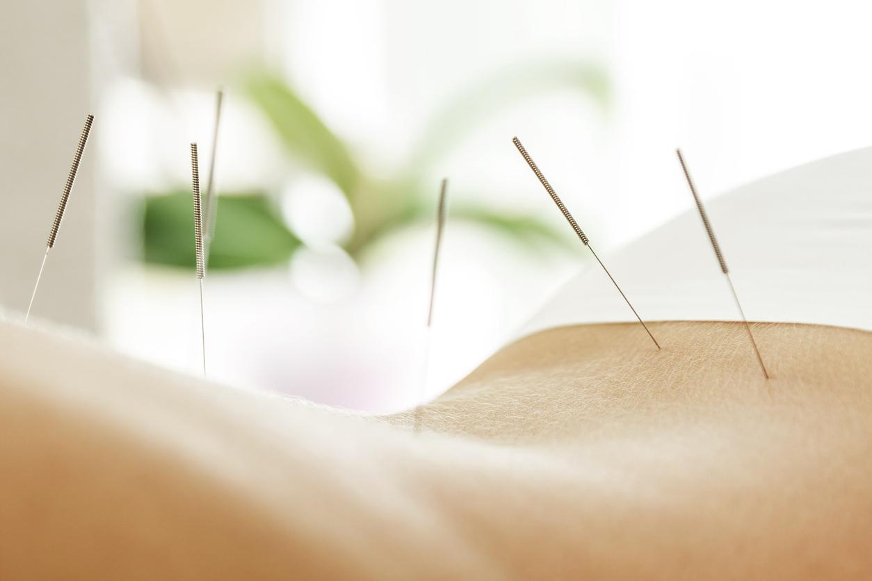 L’acupuncture peut réduire la dose de méthadone et l'envie d'opioïdes