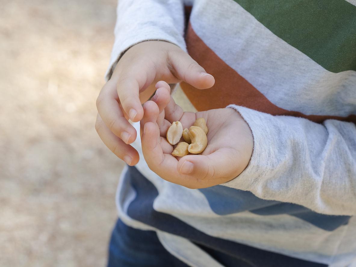 Air pollution linked to childhood peanut allergies