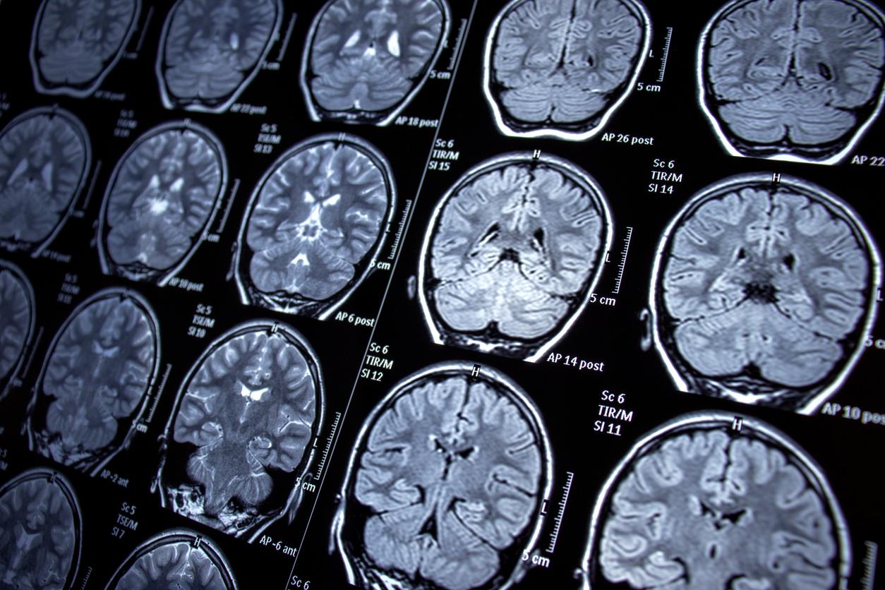 Mémoire : les neurones aidant à se souvenir des objets ont été identifiés