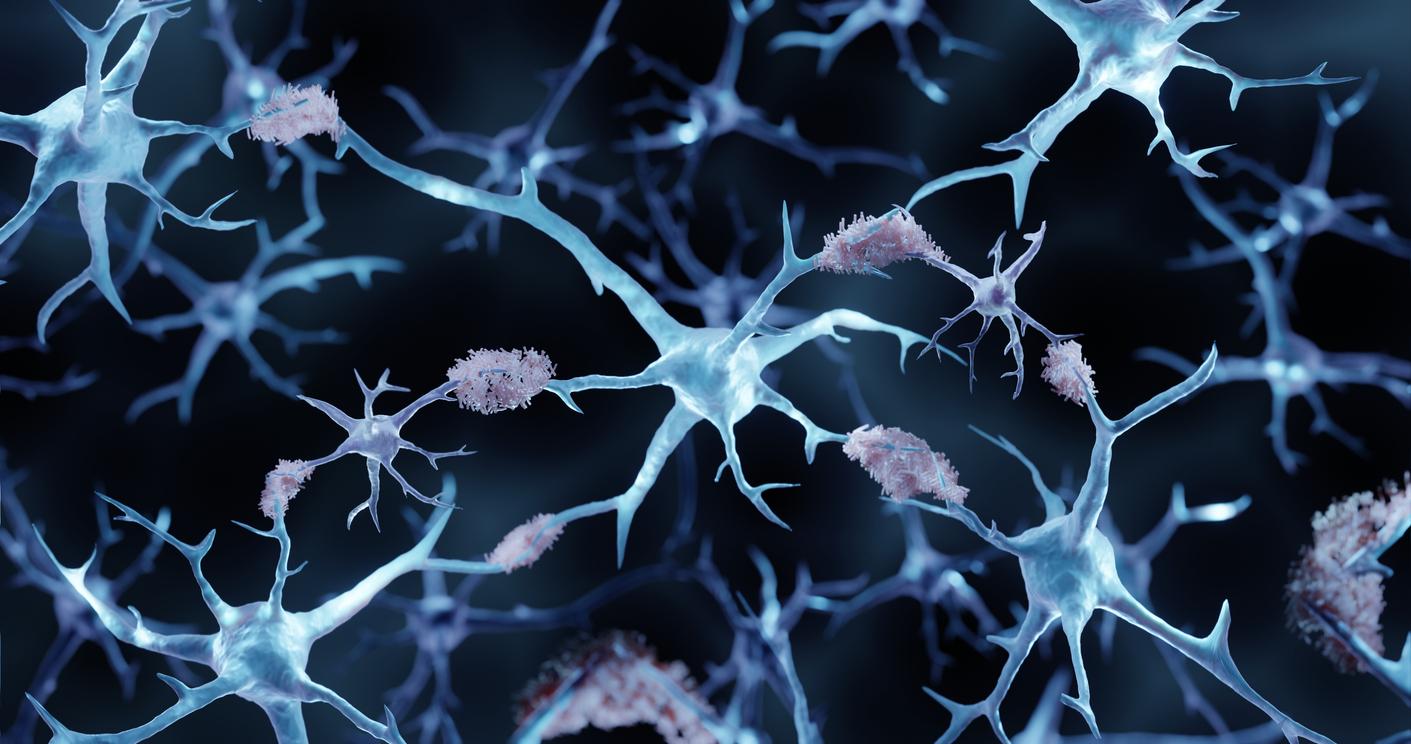 Alzheimer's disease: hope for treatment thanks to a brain-protecting protein