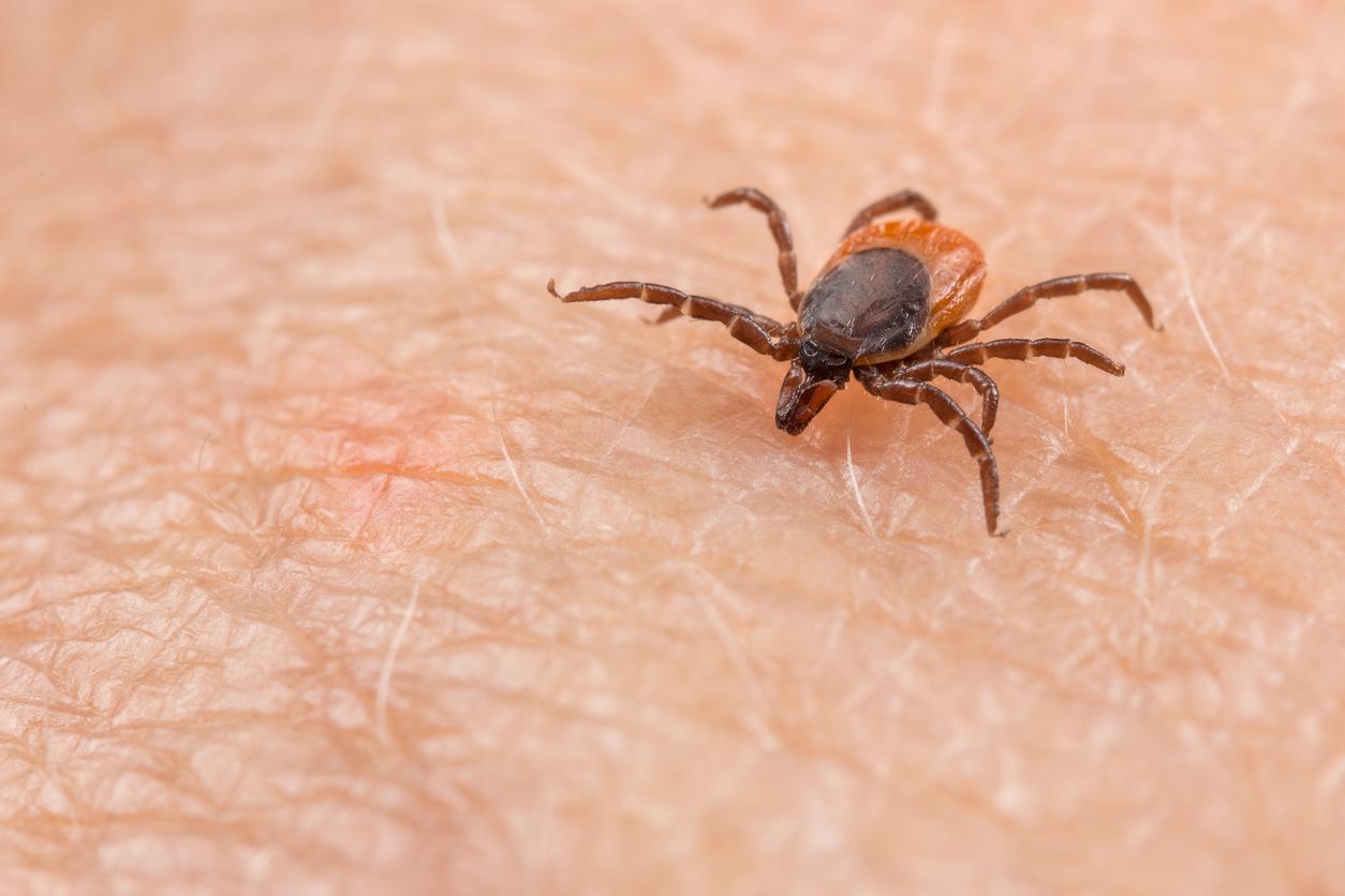 Lyme disease: Why are new HAS recommendations controversial?