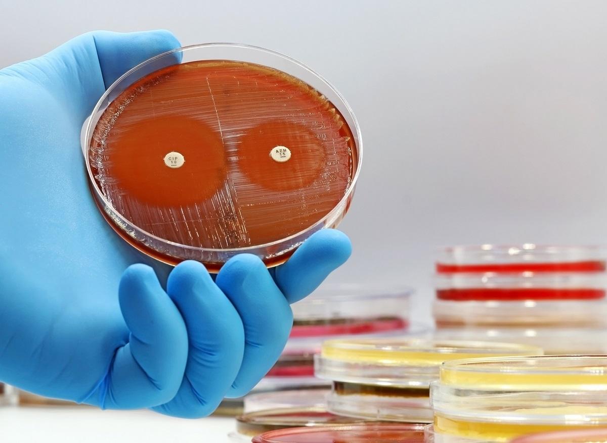 Antibiotic resistance: a scourge that threatens hospitals