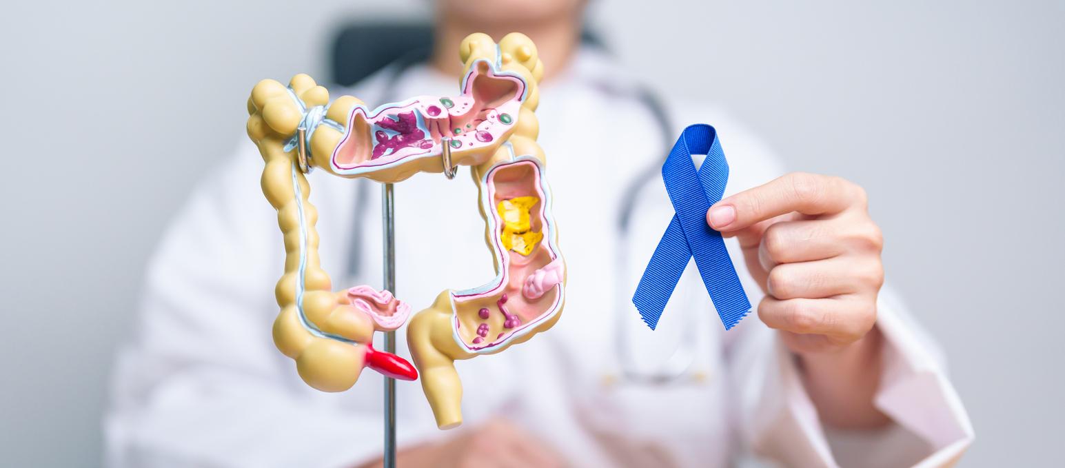 Cancer colorectal : les selles, un tabou qui coûte des vies