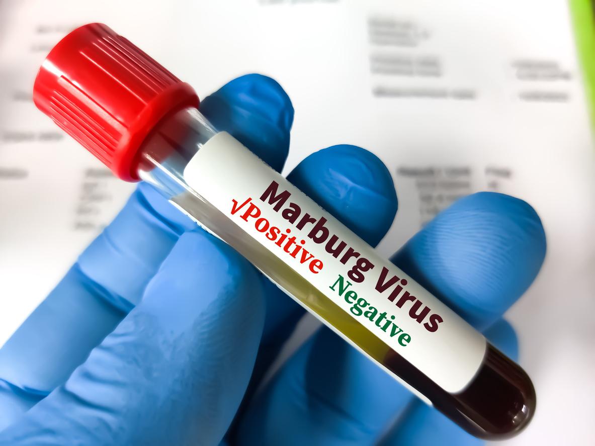 Marburg virus: what is this disease that killed 6 people in Rwanda?