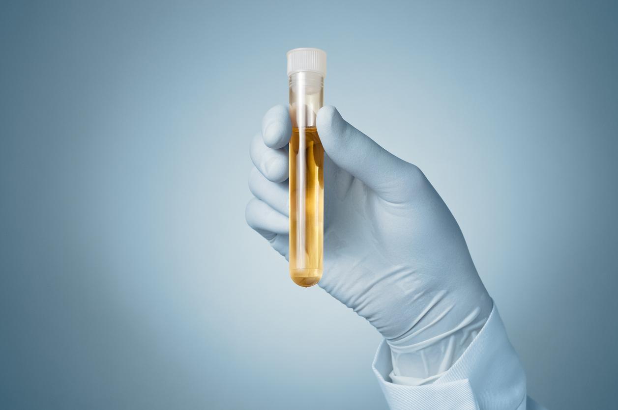 Detect diseases early using a urine test?