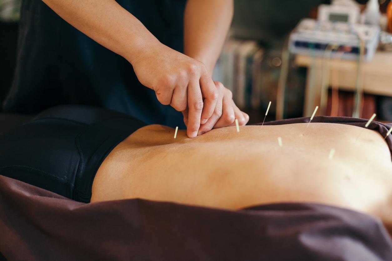 Syndrome du côlon irritable : l'acupuncture soulage les symptômes 