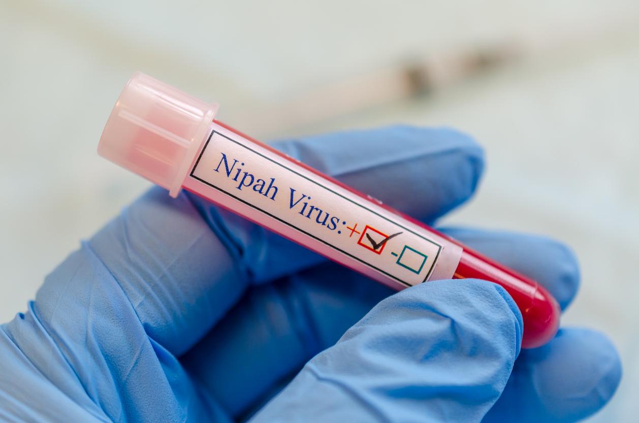 Nipah: 14-year-old boy dies of virus in India