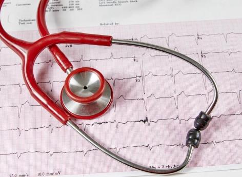 Fibrillation atriale : un nouveau traitement qui change la donne