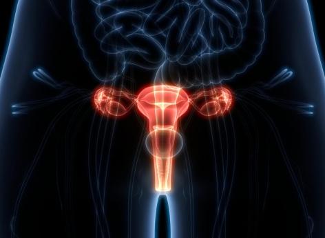 Traitement du cancer de l’ovaire : quels sont les 3 principaux moteurs du progrès ?