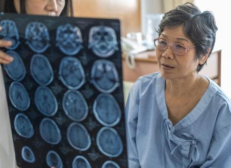Une nouvelle IA détecte la maladie d'Alzheimer avec précision