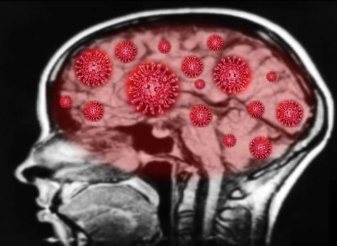 Covid-19 : l'infection fait perdre des points de QI même sous forme légère