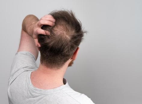 Jeûne intermittent : il retarde la pousse des cheveux 