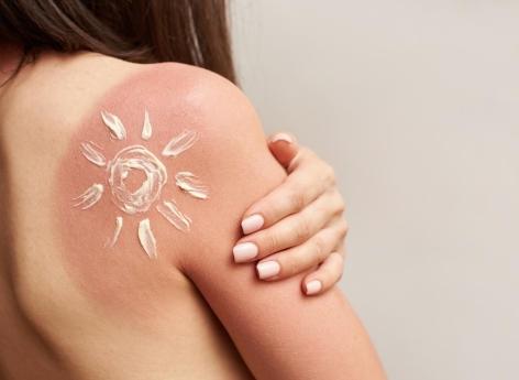 Que se passe-t-il lorsqu’on attrape un coup de soleil ? Un spécialiste en lésions cellulaires répond 