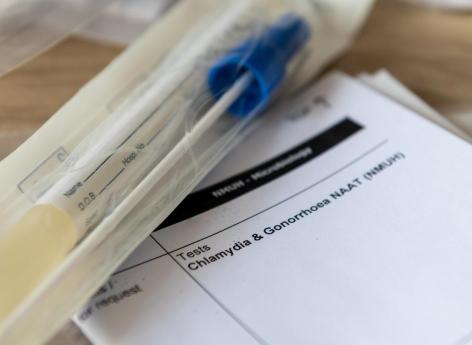 IST : dès le 1er septembre, des dépistages sans ordonnance ni frais 