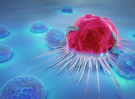 Des cellules immunitaires à l’origine de cancers identifiées