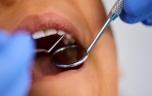 Caries : l'amidon en cause ? 