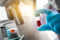 SLA : un test sanguin pourrait faciliter le diagnostic