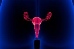 Cancer du col de l’utérus : où en est le dépistage en France ?