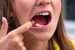 Perdre des dents au cours de sa vie augmente le risque cardiovasculaire