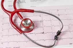 Fibrillation atriale : un trouble du rythme cardiaque bien plus fréquent qu'on ne le pensait 