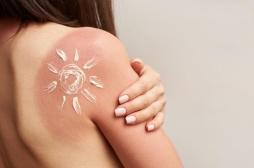 Que se passe-t-il lorsqu’on attrape un coup de soleil ? Un spécialiste en lésions cellulaires répond 