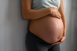 Maladie de Verneuil : cette maladie de peau présente des risques pour la femme enceinte et le bébé