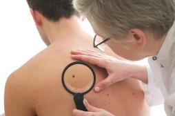 Cancer de la peau : la télémédecine et l'IA associées pour dépister le mélanome dans les Yvelines