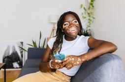 Vitiligo : la thérapie microbienne pourrait restaurer la pigmentation de la peau