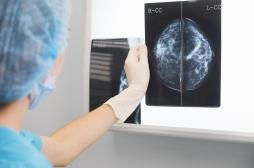 Cancer du sein triple négatif : une nouvelle cible thérapeutique découverte