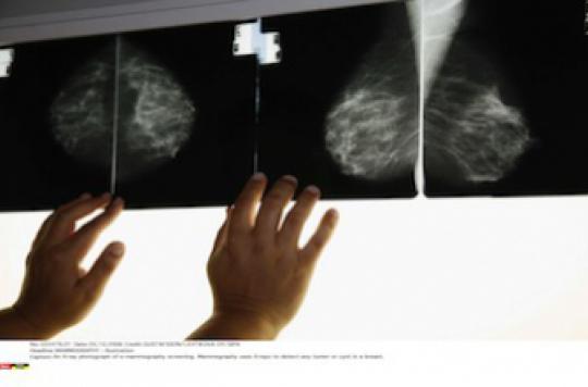 Breast cancer: double mastectomy does not improve survival