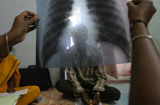 Multidrug-resistant tuberculosis: 98% left behind