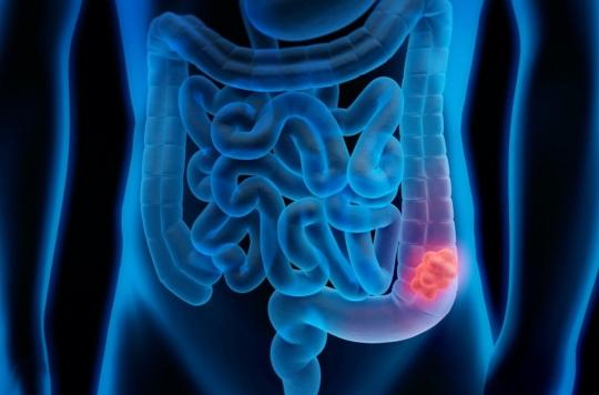 Colorectal cancer: after a positive self-test, colonoscopy too late increases the risk of discovering cancerous lesions