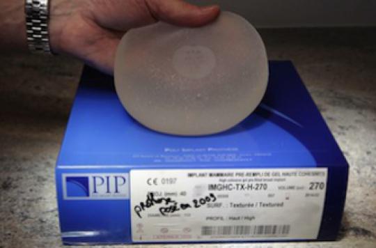 PIP implants: no need to remove intact prostheses according to experts