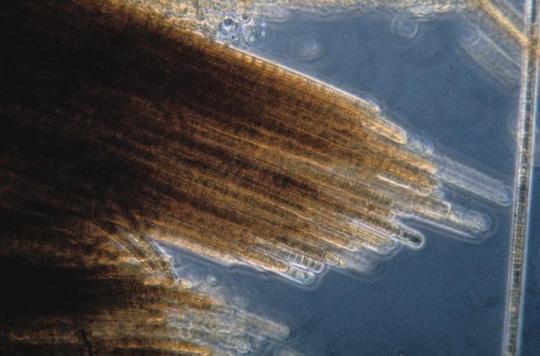 Canaries: a stinging microalgae proliferates on the beaches