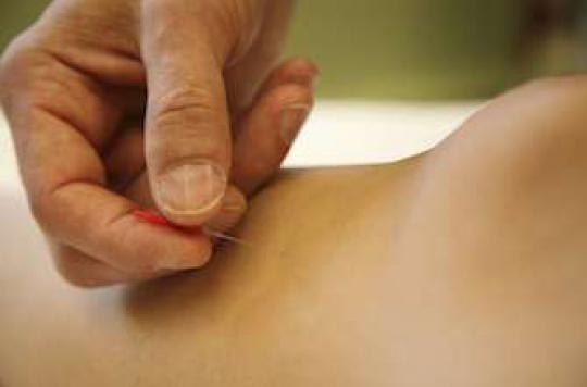 Acupuncture: more effective if you believe it