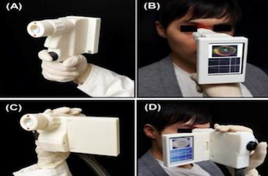 Screen for retinal diseases using a portable device