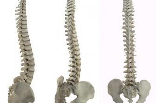 Osteoporosis, more or less effective drugs