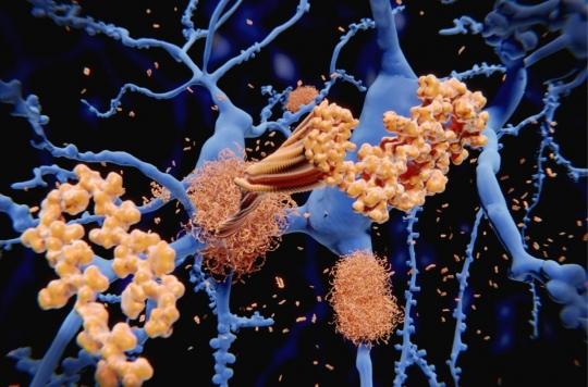 Alzheimer’s disease: the potential beneficial effects of vitamin B12