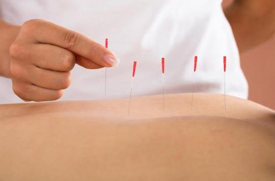 Acupuncture: how it can reduce pain