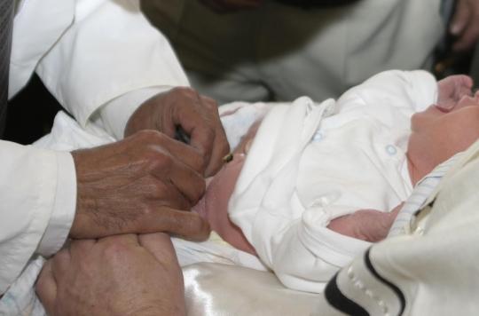 For the first time, a baby is born with three penises