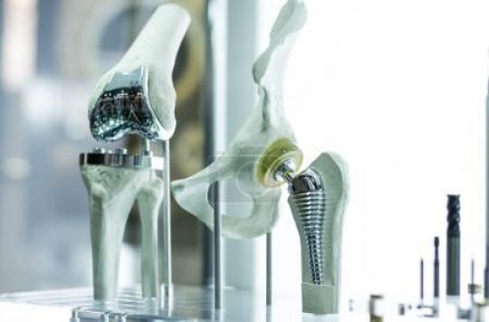 The connected knee prosthesis: a world first