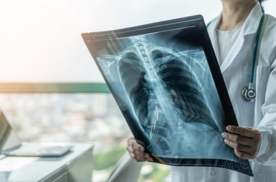 Covid: lung abnormalities found in asymptomatic patients