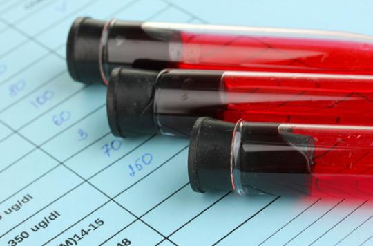 Diabetes: HIV-positive people are more at risk