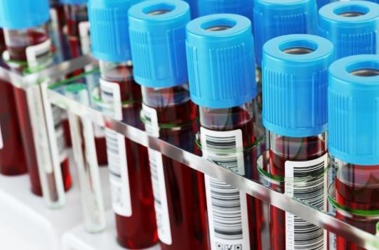 Liquid biopsy: detecting cancers through a blood test